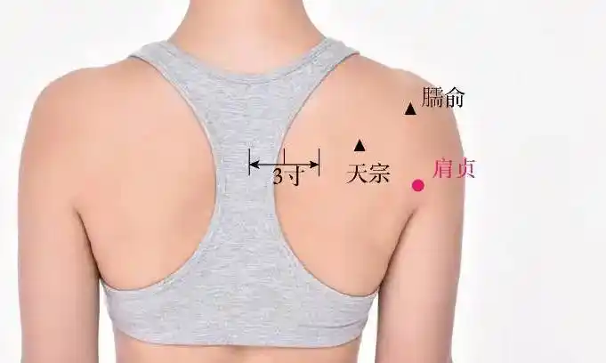 【偏方集锦第2期】肩周炎理疗篇-小药泥先生