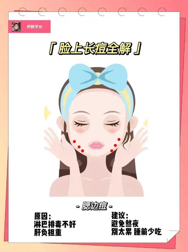 痘痘总在不同的位置冒,是什么原因呢?