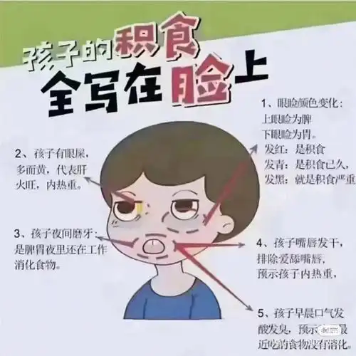 孩子的积食全写在脸上
