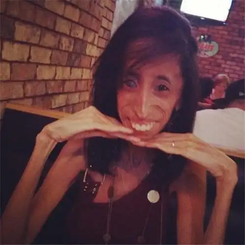 世界上最丑的女人人虽丑可其意志让人感叹