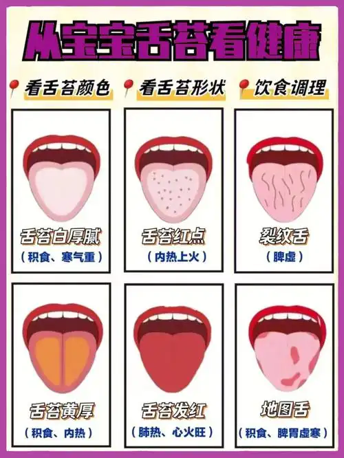 从宝宝舌头看健康晴雨表这6种情况别忽视