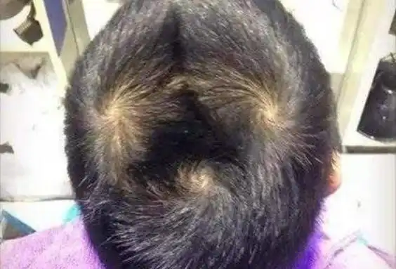 柠檬:我是头顶2个"旋"的女孩,但我脾气真的很好,身边人都说和谁红脸