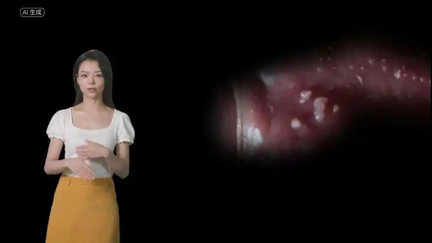 男性珍珠疹与系带旁腺症状图片对比-南京圣贝医院