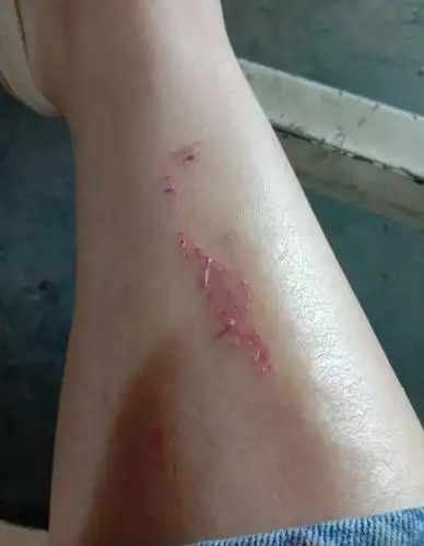 整条腿鲜血淋漓绍兴女子曝光老公和小三要开车撞死我还去法院起诉离婚