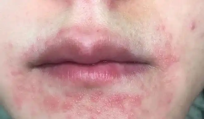 毛孔自动吐出芝麻粒韩国女星都用它5分钟皮肤白嫩得像剥壳鸡蛋45岁一