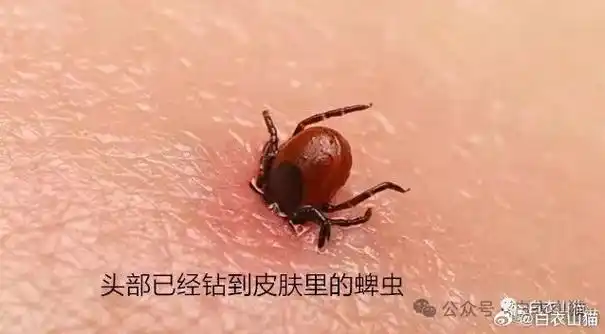 #微博新知##全民慢病健康科普计划#