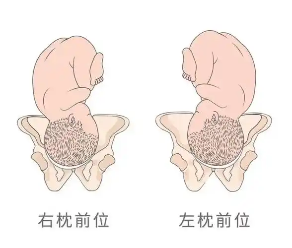 b超单上显示这 4 个大字,恭喜你,已拿到顺产「通行证」_胎儿_胎位