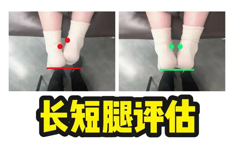 功能性长短腿评估|怎样判断自己是否有长短腿?