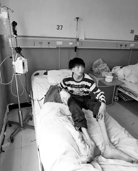 14岁男孩张文祥正在打点滴,他患有马凡氏综合征,身高176厘米,体重却不