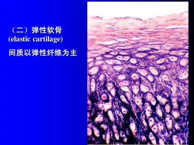 组织学与胚胎学课件 软骨 (二)弹性软骨 (elastic cartilage) 间质以