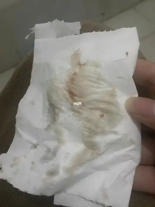 孕早期褐色分泌物