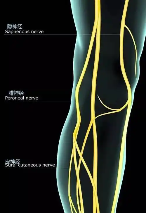 隐神经痛综合征～膝关节前内侧疼痛病因之一!