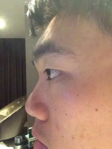 问:我的鼻子是蒜头鼻吗?我的鼻子是什么类型的呢?