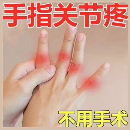 手指关节痛专用腱腱鞘炎贴手握手腕大拇指手部五指疼痛药膏疼痛贴