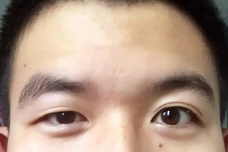 大小眼怎么破!感觉没有爱了!