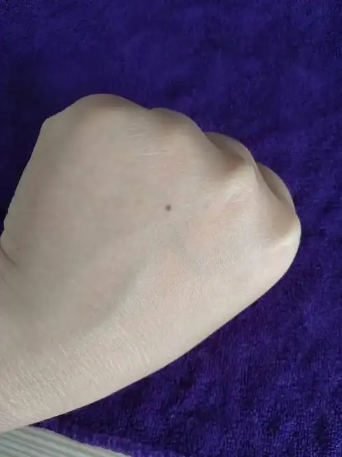 这款是什么痣?手背长这颗痣有什么寓意嘛?