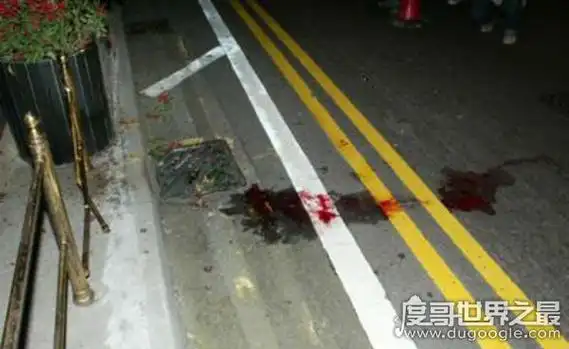 张国荣患严重抑郁跳楼自杀