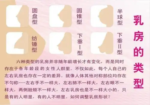 1)圆盘型:乳房隆起不高,但底部不小,整个乳房很散,像薄薄的两个盘子挂