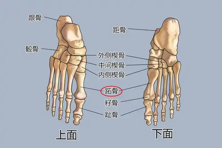 一,跖疣是什么?