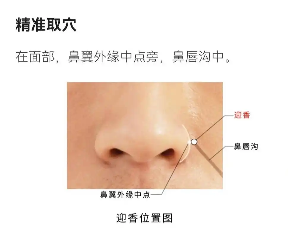 💬取穴:迎香穴具体位置,大约在鼻翼外缘中点5~8毫米处,左右各一个.