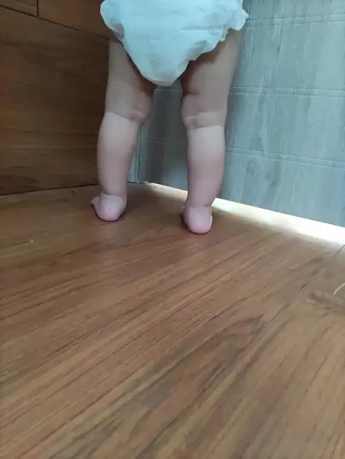 帮忙看看宝宝的脚是不是足内翻#足外翻