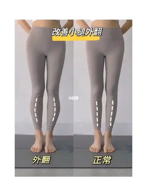 78小腿外翻73有救啦60秒变的纤直腿05