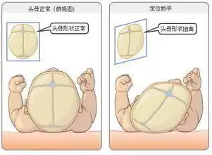 让宝宝拥有一个帅头型,赢在人生起跑线只看楼主