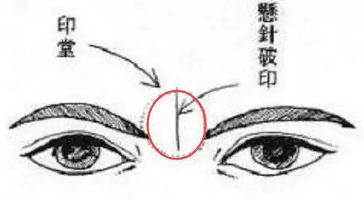 眉间一竖纹什么说法