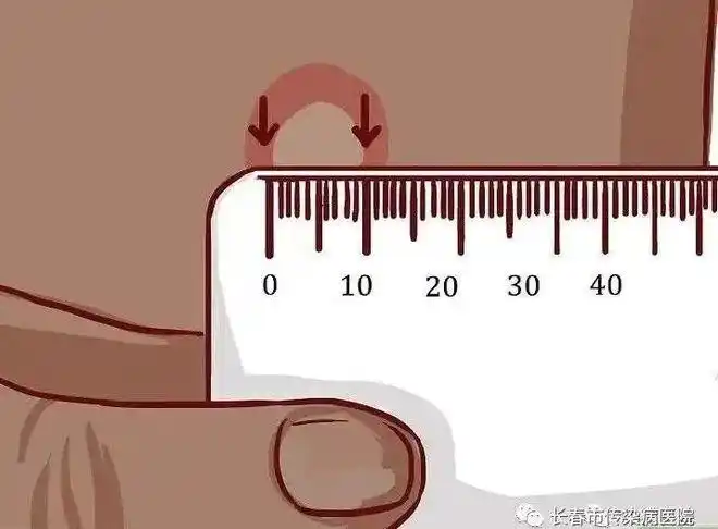 ppd|结核菌|卡介苗_网易订阅