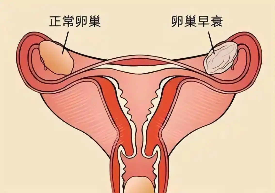 患上卵巢囊肿身体会有哪些表现呢有这些症状别大意