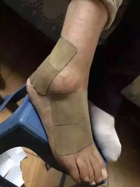 27岁脚后跟长骨刺,怎么办