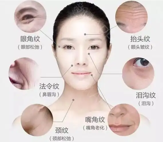 30多岁的女人长皱纹不用慌,用这几个小妙招!皱纹还会爬上脸?