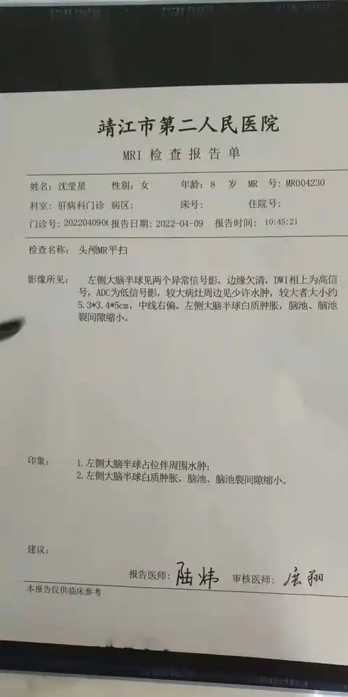 微靖江靖江8岁女孩头部恶性肿瘤在苏州急需o型血进行手术