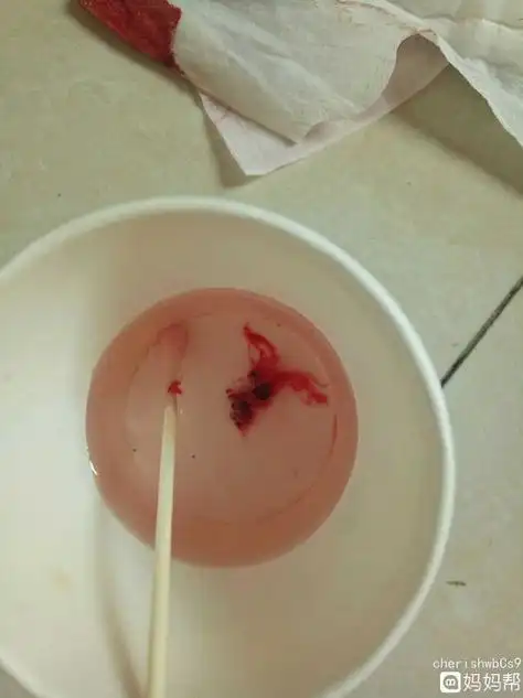 40天药流排出孕囊图片 - 搜狗图片搜索