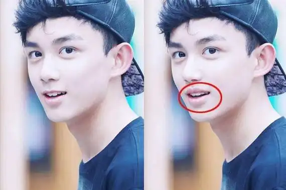 明星脸都有硬伤:吴磊萌是上唇短,倪妮微调后简直认不出