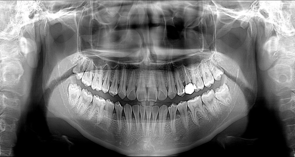 直播带货不卖口红卖口腔ct5个半小时309台