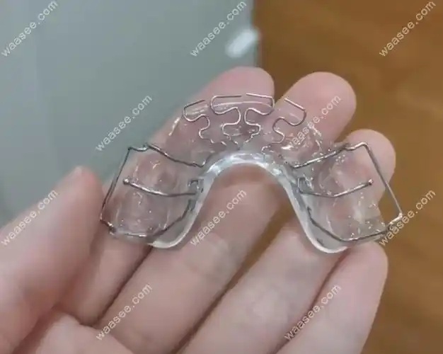 矫正牙套多少钱价格表2022,含钢牙套/儿童早期干预矫正费用 - 口腔