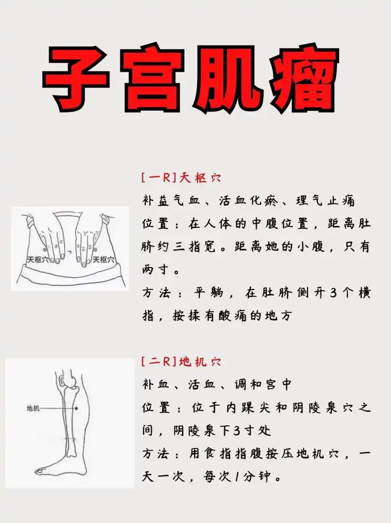 查出子宫肌瘤,每天按摩这2穴位,肌瘤慢慢消!