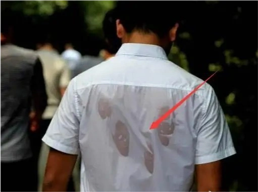 后背容易出汗是怎么回事?