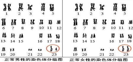 正常人的体细胞中的染色体可以分为两类:一类是与性别决定无关的
