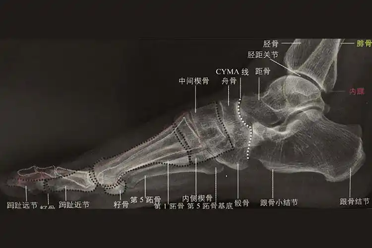 足侧位x线解剖图