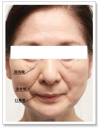 "三八线"让你老了不止10岁,这样做就对了!