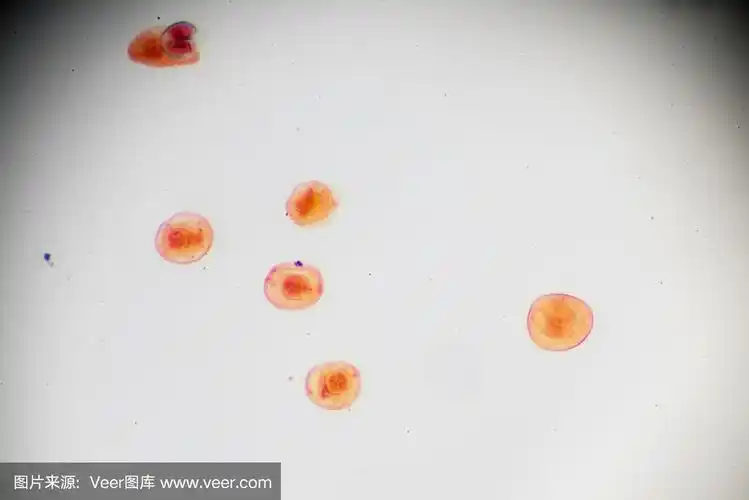 猪带绦虫卵的光镜观察