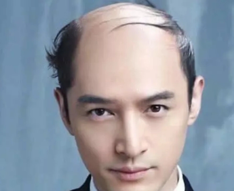 发型,而明星大家都知道一直都是光鲜亮丽的,但是当男星拥有地中海头型