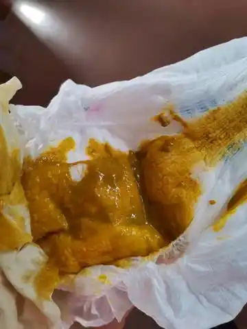 宝宝腹泻可能是消化不良引起的也可能是着凉了,或是细菌感染,因为宝宝