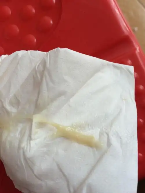 月经刚过,白带多而稠,什么问题啊