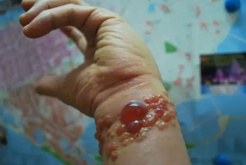 可是,美丽的水母啊,你的每一次热吻,都让我难忘,让我记忆犹新,因为,我