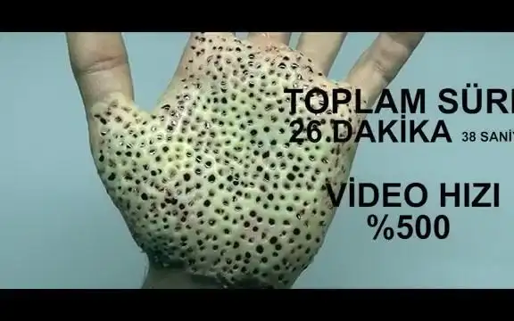 【密恐福利向视频】()滑稽