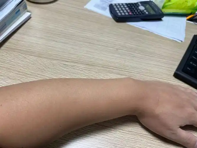 胳膊 汗毛特别少 有多少人像我一样