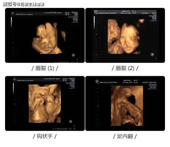 检查_胎儿_孕妇